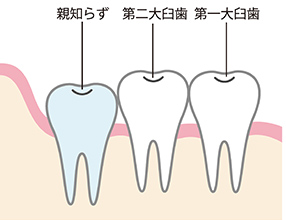 正常に生えている